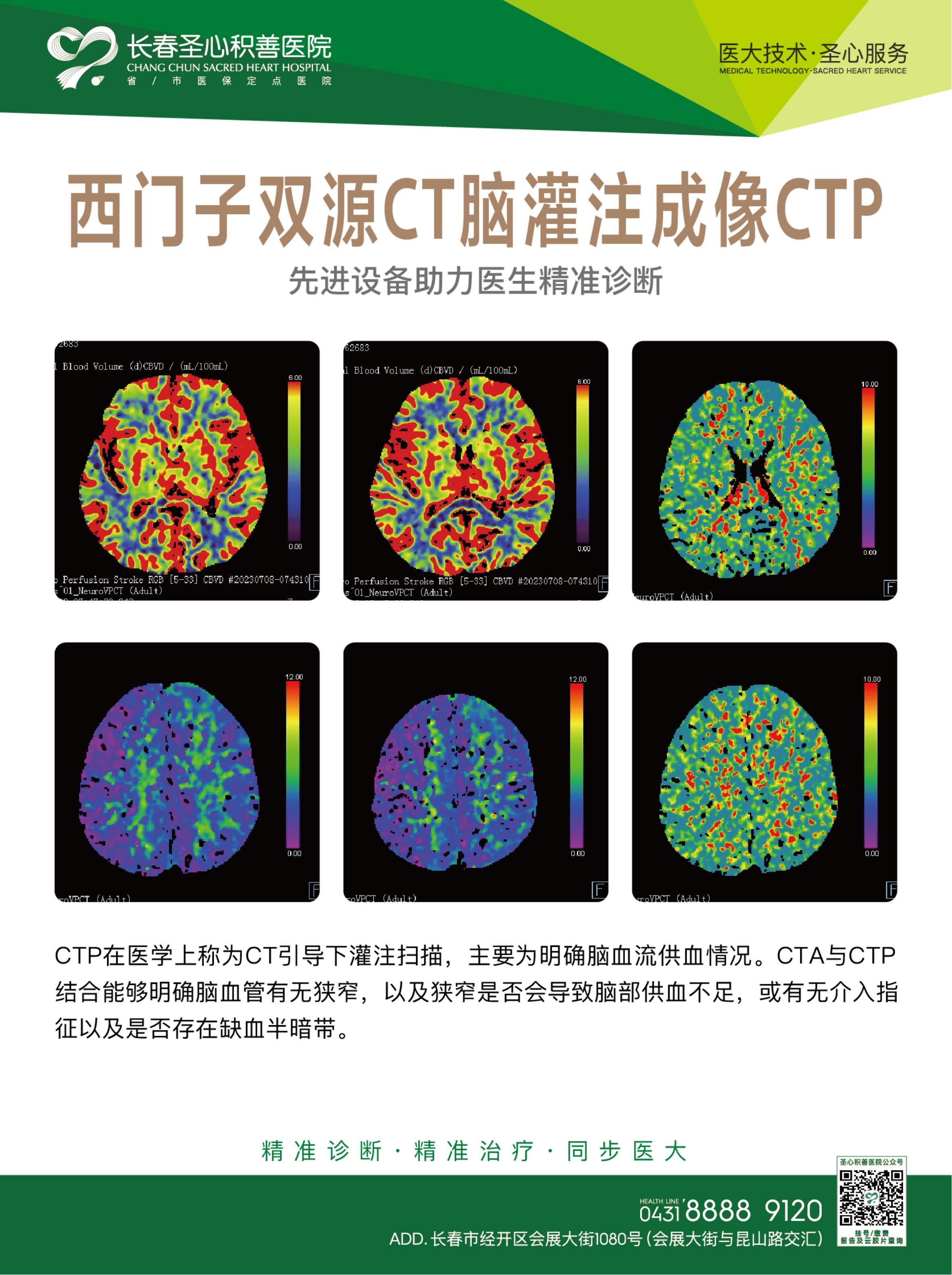 西门子双源CT  8.jpg