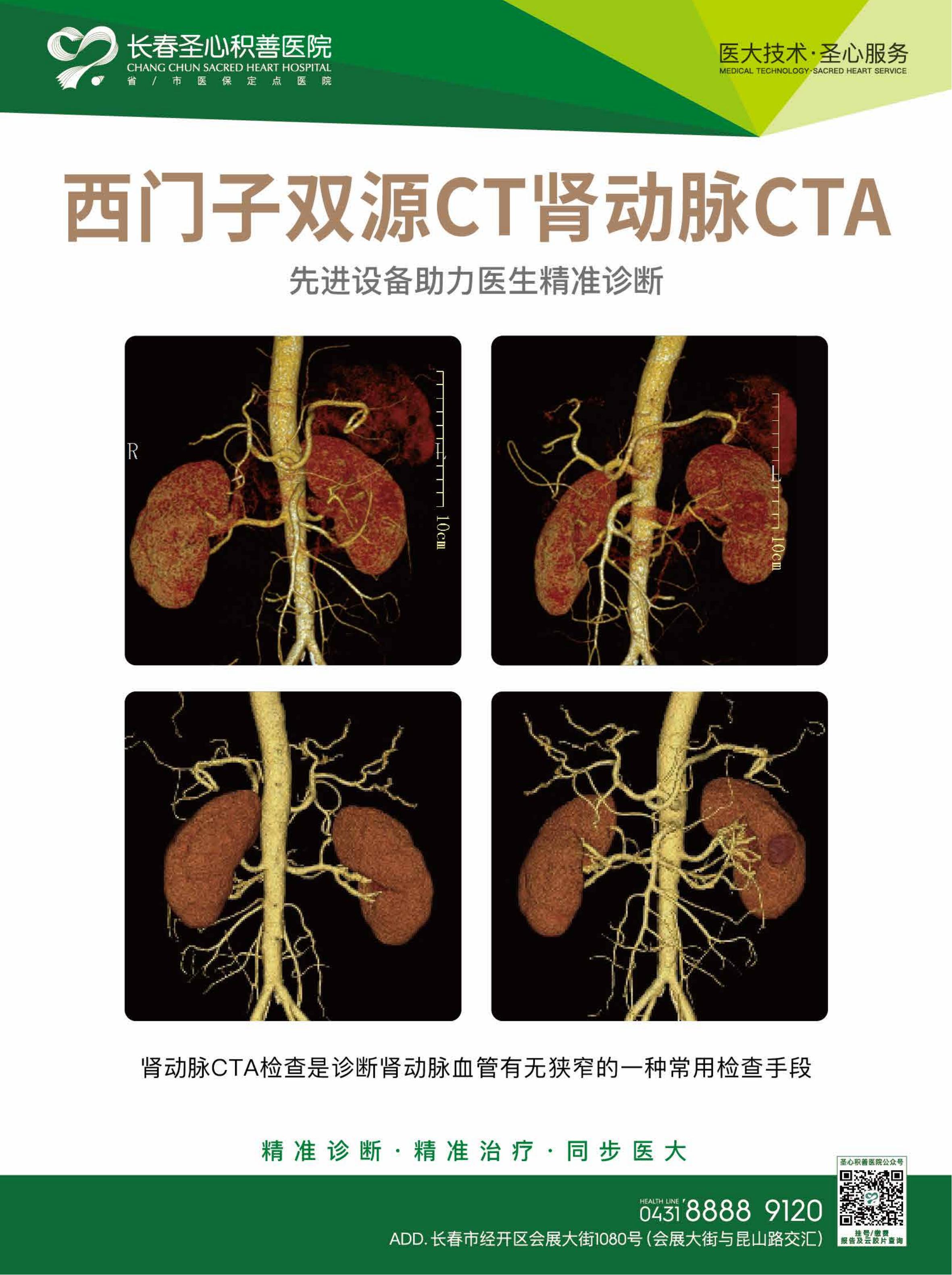 西门子双源CT  6.jpg